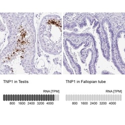 TNP1 Antibody, Novus Biologicals 0.1mL; Unlabeled:Antibodies, Polyclonal